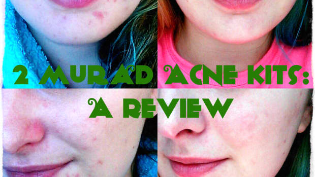 60-day-challenge-review-of-murad-30-day-acne-starter-kit