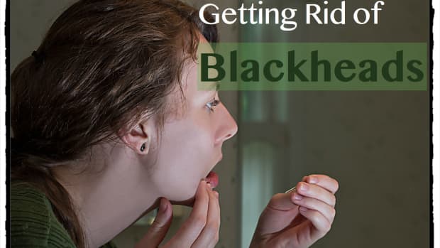 get-rid-of-blackheads-on-nose