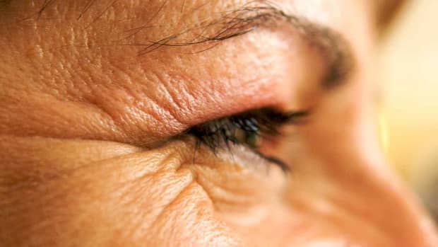 glycerin_anti-aging_moisturizer_restores_elasticity_to_eye_area