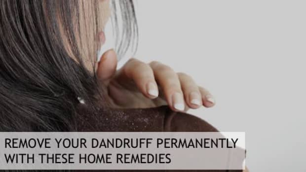 how-to-remove-dandruff-permanently