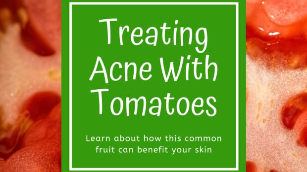 how-to-treat-acne-tomatoes