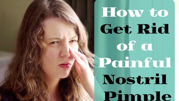 pimple-in-nose-try-this-easy-method-for-rapid-relief
