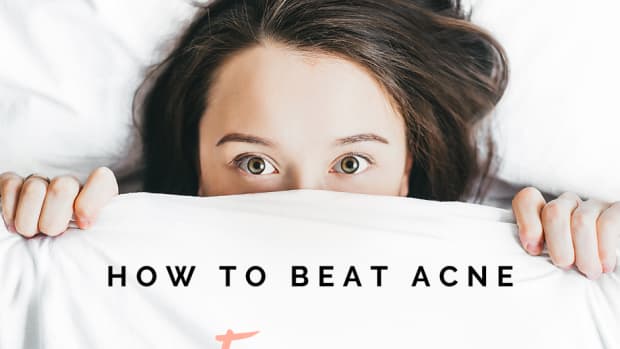 three-solutions-to-solve-your-acne-forever